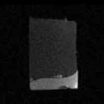 磁共振T1和T2的区别